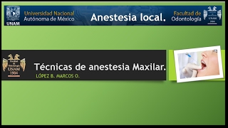 Técnicas de anestesia maxilar [upl. by Magree]