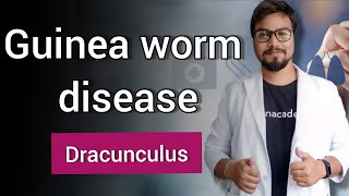 Guinea worm disease Dracunculiasis  Dracunculus [upl. by Nannah]