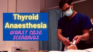 Thyroid Anaesthesia Worst case scenarios [upl. by Brenner]