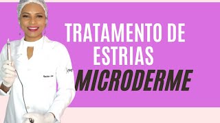 Tratamento de estrias Microderme [upl. by Mozart]