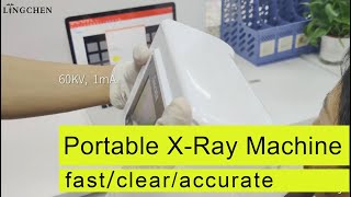 The use of Portable XRay Machine with Sensor  fast clear and accurate [upl. by Sayres887]