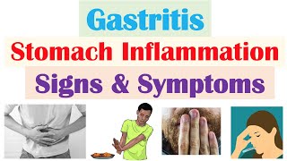 Gastritis Stomach Inflammation Signs amp Symptoms Complications amp Why They Occur [upl. by Eelarbed708]