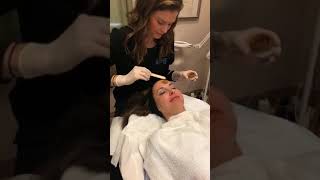 Janelle Gets a Cosmelan Peel at LJCSC [upl. by Rases]