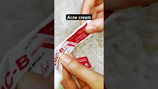 Best acne cream watch full vedio on youtube channel acnetreatmentshortsfeed shortsviralshorts [upl. by Obola]