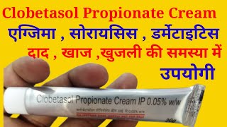 Clobetasol Propionate Cream Uses in Hindi  क्लोबेटासोल प्रोपियोनेट क्रीम के बारे में जानकारी [upl. by Palocz]