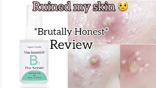 Organic traveller quotNiacinamidequot serum review ruined my skin 😥 [upl. by Eical]