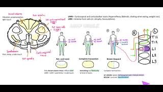 Spinal cord lesions Spinothalamic tract UMN and LMN BrownSequard As easy as it gets [upl. by Ellecrad]