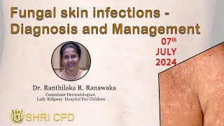 Managing And Diagnosing Fungal Skin Infections With Dr Ranawaka [upl. by Euginimod164]