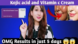 Kojic acid and vitamin c cream honest Review Kojic acid vitamin C creamगोरा करने वाली क्रीम। [upl. by Peursem]