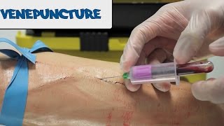 Venipuncture  How to take Blood  OSCE Guide old version  UKMLA  CPSA [upl. by Zined161]