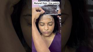 Natural Hair Line Patch Solutions You Need to See [upl. by Eiveneg]