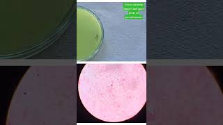 Gram staining image of pseudomonas and agar plate image [upl. by Niatsirhc518]