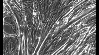 C2C12 muscle cell contractions Part II [upl. by April]