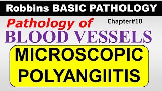 Ch10  MICROSCOPIC POLYANGIITIS  Blood Vessel Pathology  Robbins Lectures [upl. by Annahsad]