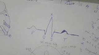 ECG formation  18 axe du QRS [upl. by Inittirb]