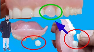 How to repair a broken denture tooth  How to fix a broken denture tooth at homeTooth repair [upl. by Leirej934]