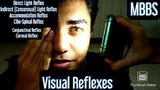 Visual Reflexes Direct Light Reflex Indirect Consensual Light Reflex Accommodation Reflex mbbs [upl. by Peppard]