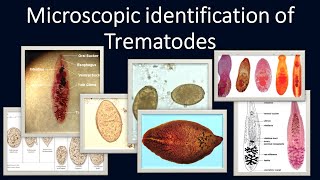 Microscopic identification of Trematodes [upl. by Irollam863]