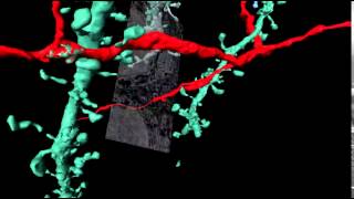 3Dreconstruction of nerve cells [upl. by Cullie]