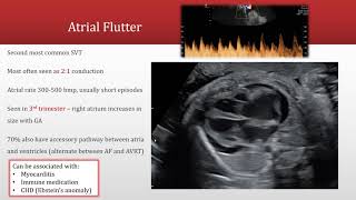 Fetal Arrhythmias Part 2 Assessing Tachyarrhythmia and Bradyarrhythmia [upl. by Brandy]