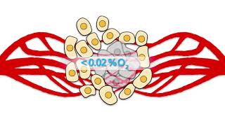 Hypoxia Inducible Factors HIFs Part 1 Tumor hypoxia [upl. by Afesoj66]