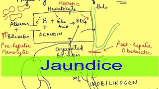 Hemolytic hepatic amp obstructive Jaundice  Icterus  Gastrointestinal Physiology  Pathophysiology [upl. by Fedirko]