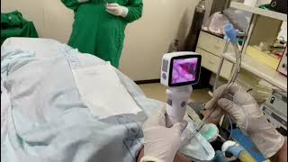 Postman video laryngoscope for airway intubation [upl. by Yarg10]