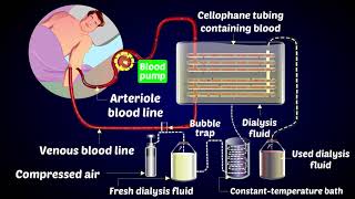 How a Dialysis Machine Works  Dialysis  ARTIFICIAL KIDNEYS [upl. by Berti471]