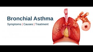 Bronchial Asthma [upl. by Alexa34]