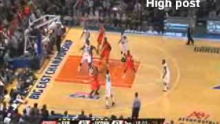 Syracuse 23 zone defense [upl. by Jenna]