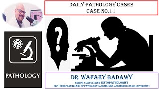 DIALY PATHOLOGY CASES CASE NO 11 Dr Wafaey Badawy [upl. by Eidob]