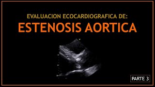 ESTENOSIS AORTICA Evaluacion ecocardiografica  PARTE 3 [upl. by Trinl]