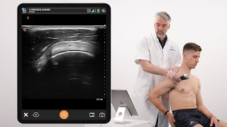 Dynamic Assessment of Ligaments of the Coracoid Process and Supraspinatus Tendon [upl. by Nicolau]