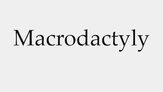 How to Pronounce Macrodactyly [upl. by Ehud23]