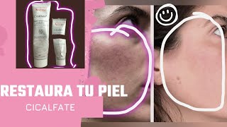 Mi Experiencia Reparando mi piel Irritada y Seca con Cicalfate de Avene [upl. by Leahicm964]