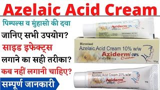 Azelaic Acid Cream Azelaic Acid Cream 10 ww Azelaic Acid Cream 20 ww in Hindi [upl. by Jamesy378]