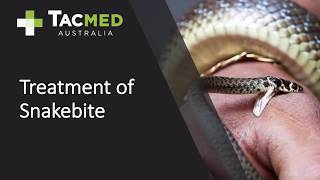 Treatment of Australian Snakebite [upl. by Nylyahs]