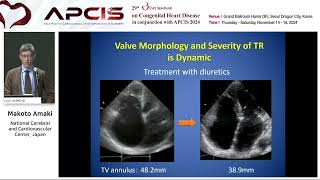 Pacemaker Induced TR or Functional TR What is the Best Option for Treat [upl. by Adnauqahs]