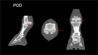 Palmar Osteochondral Disease Case Study [upl. by Linoel]