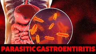 PARASITIC GASTROENTIRITIS [upl. by Yeliw]