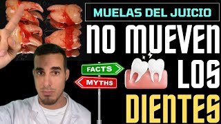 Las MUELAS del JUICIO NO DESPLAZAN LOS DIENTES  Mito desmentido✅ [upl. by Hodess]