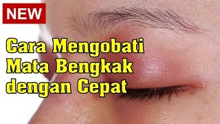 Cara Mengobati Mata Bengkak dengan Cepat [upl. by Jobina]