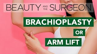 Arm Lift or Brachioplasty  Beauty and the Surgeon Episode 47 [upl. by Junia]