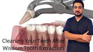 Cleaning Your Teeth After Wisdom Tooth Extraction [upl. by Hersh]