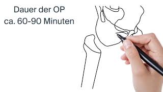 WechselOperation künstliches Hüftgelenk by ATOS Kliniken [upl. by Cook]