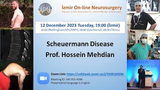 İON 403 lecture Mehdian Scheuermann Disease 04122023 [upl. by Kampmeier873]