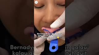 BERNADYA B nya Butuh Duit untuk pasang behel 💯 dentist doktergigi dentalclinic orthodontist [upl. by Jer]