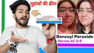 Pernex Ac Gel Review  Benzoyl Peroxide 25 Review [upl. by Lorollas]