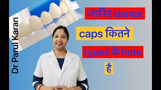 जानिए कितने प्रकार के Dental caps crowns होते है [upl. by Elbertina]