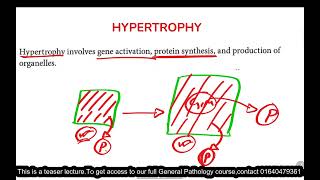 Cellular Adaptations  Growth Adaptation  Pathology  Bangla [upl. by Halilahk544]